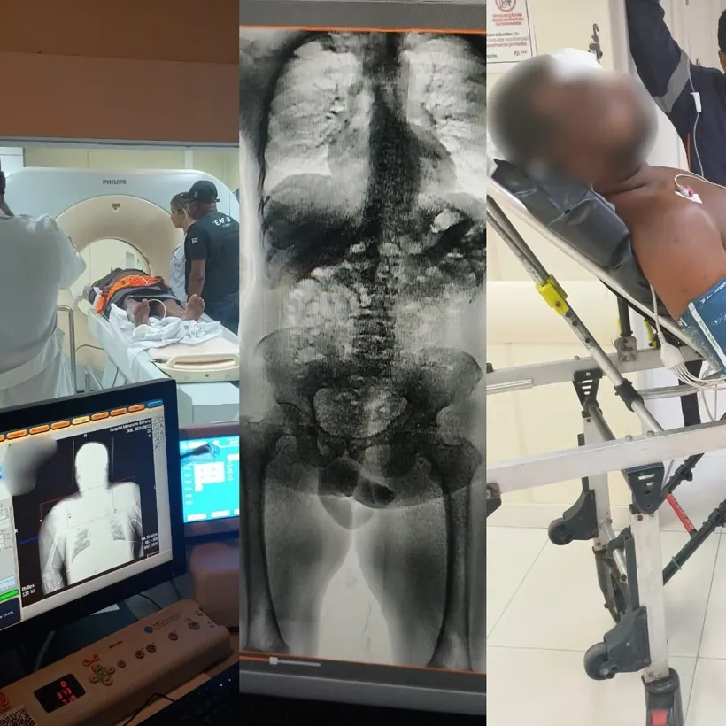 Internos do Conjunto Penal de Lauro de Freitas são flagrados com drogas no estômago após saída temporária