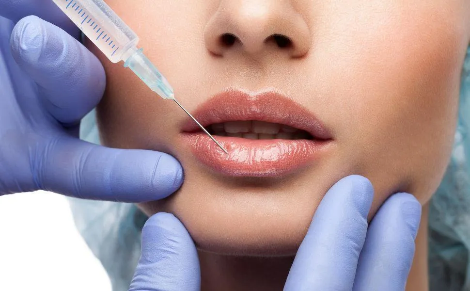 Justiça decide que dentistas não podem fazer harmonização facial. Foto: Ilustração