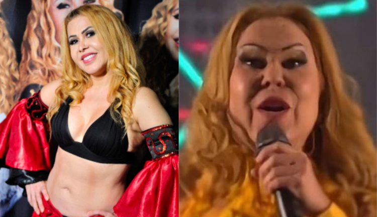 Cantora preocupou fãs recentemente ao aparecer inchada em show. Reprodução/Internet