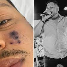 Reprodução / Internet