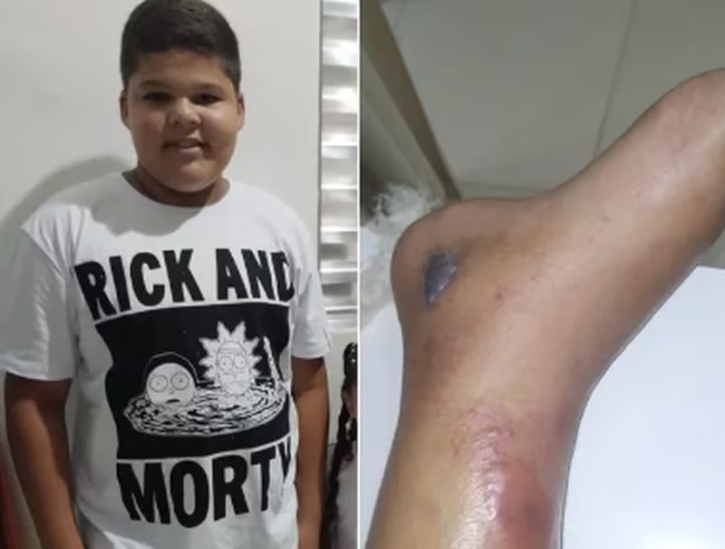 Arthur Barros da Silva, de 12 anos, morreu dias depois de fraturar a perna enquanto jogava futebol, no Guarujá, litoral de SP. Foto: Reprodução
