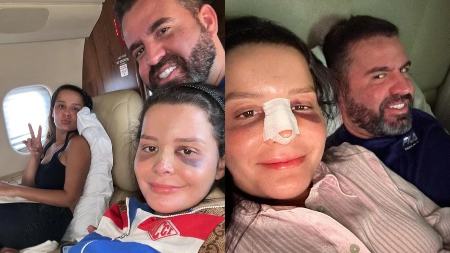Maraisa quebra o nariz após acidente em jacuzzi de hotel. Foto: Reprodução/Instagram 