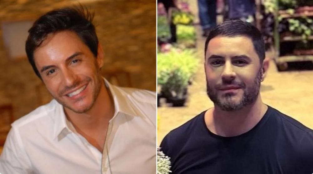 Ricardo Tozzi antes e depois de supostos procedimentos estéticos Reprodução Internet