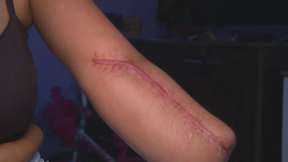 Mulher é internada para dar à luz e tem mão e punho amputados no Rio de Janeiro — Foto: Reprodução/ TV Globo