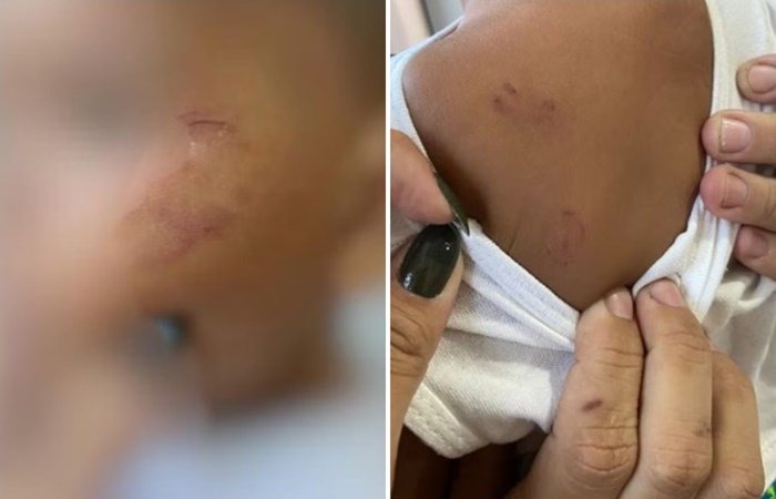 Reprodução / Internet