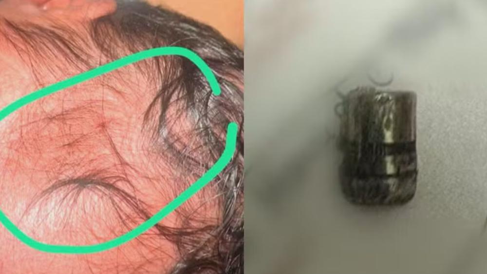 A recém-nascida foi atingida por um tiro dentro de um hospital quatro horas após nascer. Foto: Divulgação