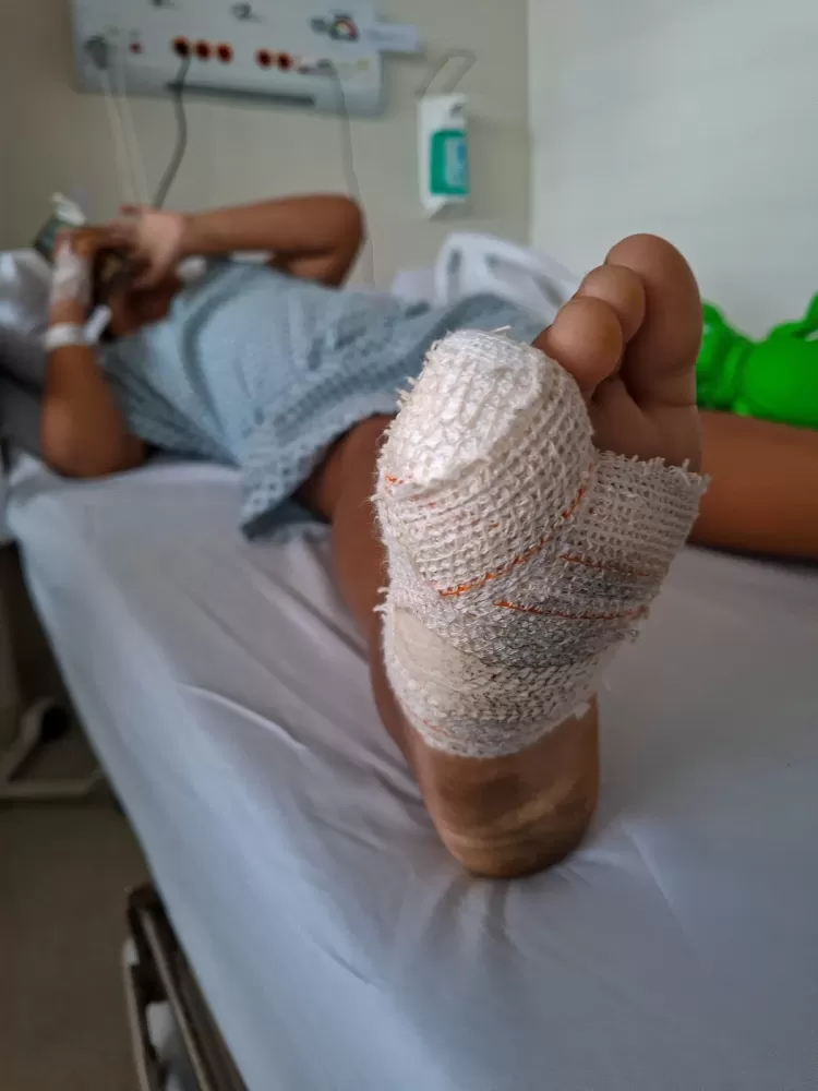 Henzo Gabriel, de 8 anos, teve parte do dedo mindinho do pé direito amputada. Foto: Arisson Marinho/Correio