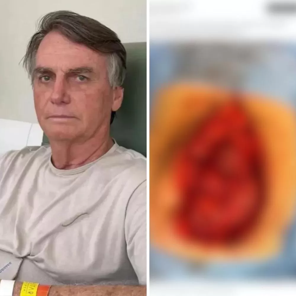 O ex-presidente está internado desde o dia 11 de abril no Hospital DF Star, em Brasília.Foto: Reprodução/Internet