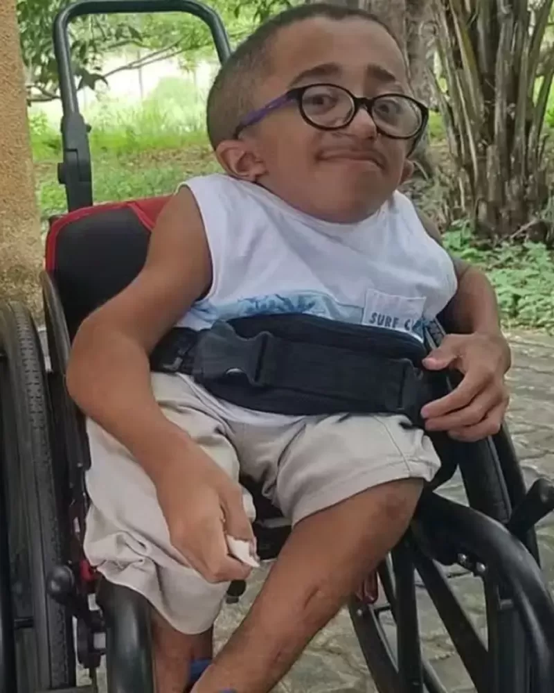 Adolescente com ‘ossos de vidro’ morre aos 15 anos. Foto:Reprodução