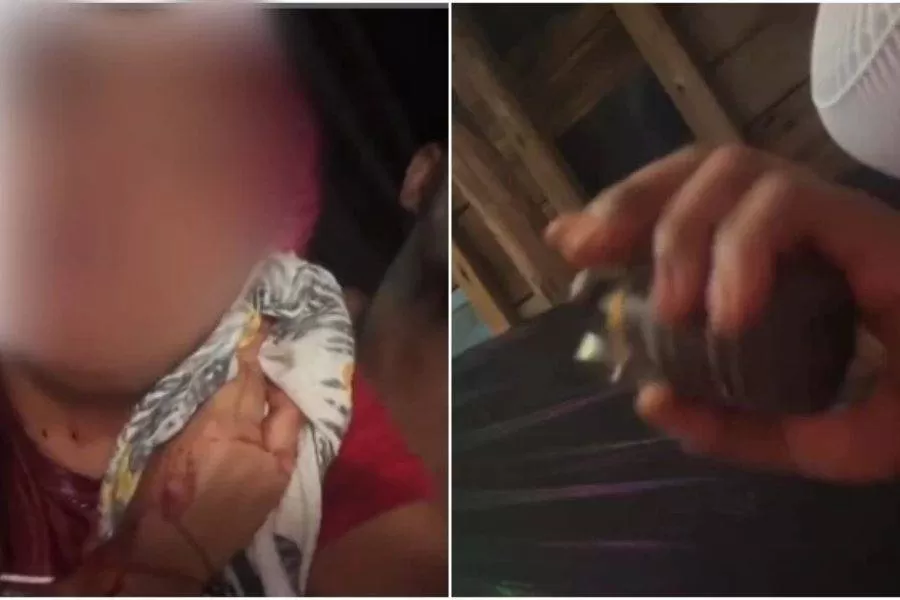 A vítima foi baleada no pescoço e filmada por moradores coberta de sangue. Foto: Reprodução