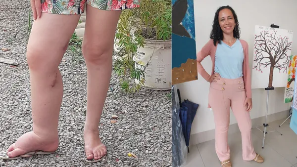 Elizabeth Rezende passou por microcirurgia rara na Bahia. Foto: Reprodução