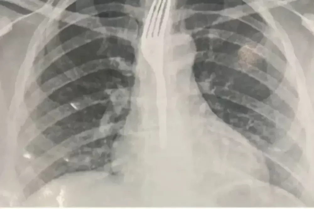 Foto: Reprodução/Internet