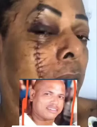 Mulher trans é vítima de tentativa de homicídio em Madre de Deus. Foto: Reprodução/Redes Sociais