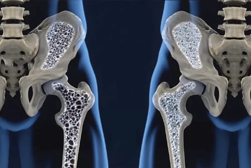 Reprodução/Internet