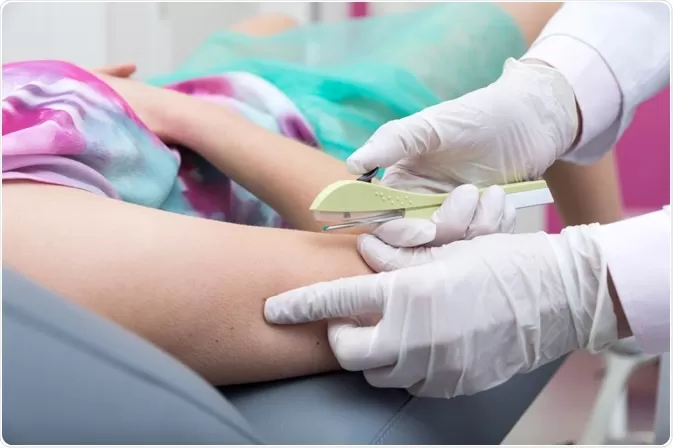 Na rede privada, Implanon custa até R$ 4 MIL. Foto: Reprodução/Internet