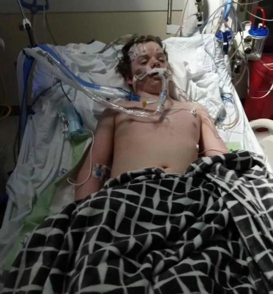 Pai compartilhou uma foto do filho ligado a equipamento de suporte de vida no hospital a fim de conscientizar pais e filhos sobre os riscos que os desafios do TikTok podem causar. Foto: Reprodução/Twitter/@alfinetei