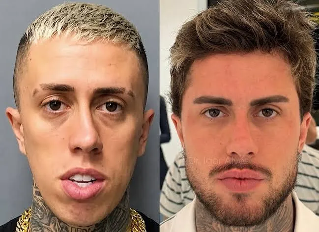 Antes e depois de MC Daniel. Foto: Reprodução/Internet
